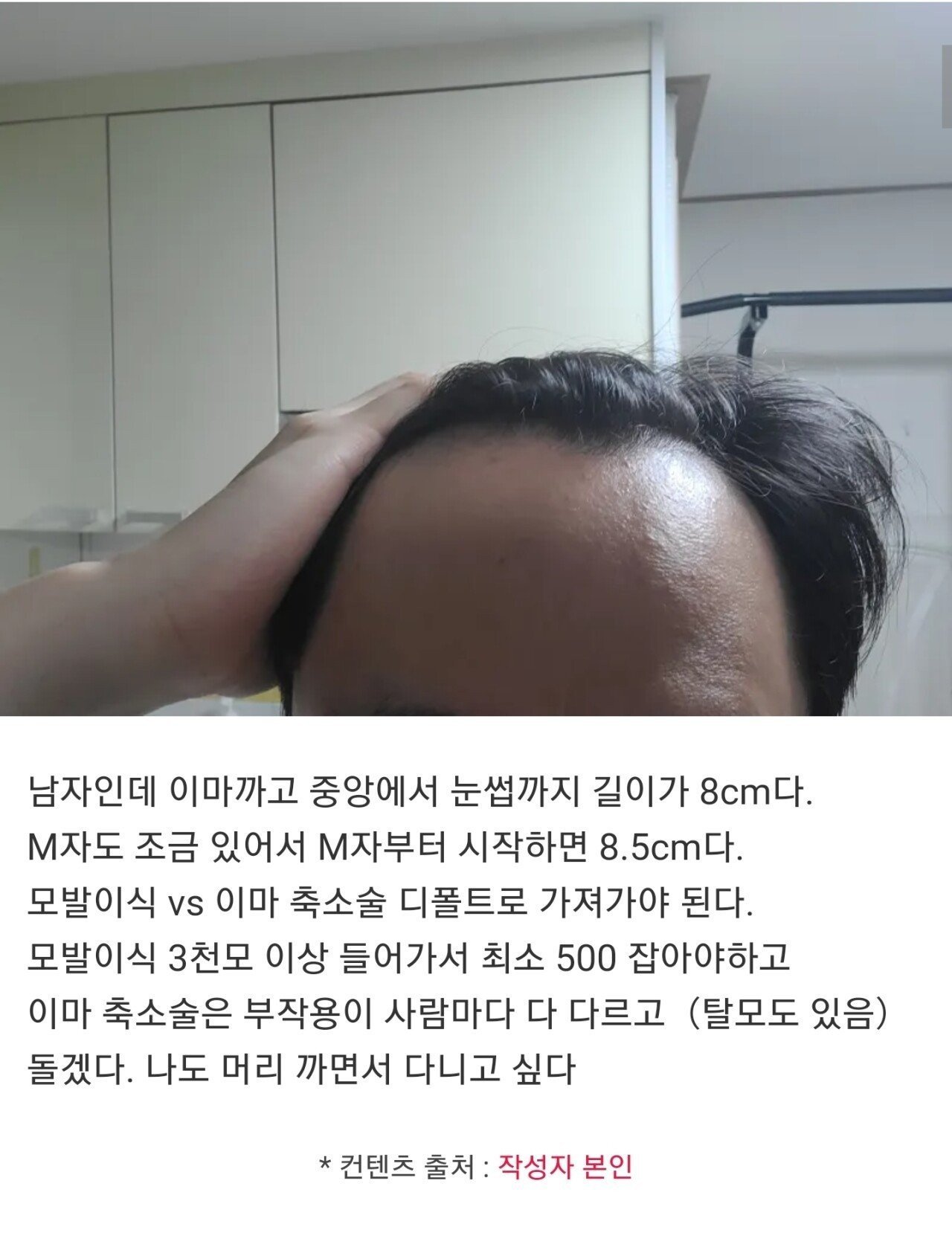 이마 8cm다...자괴감든다...