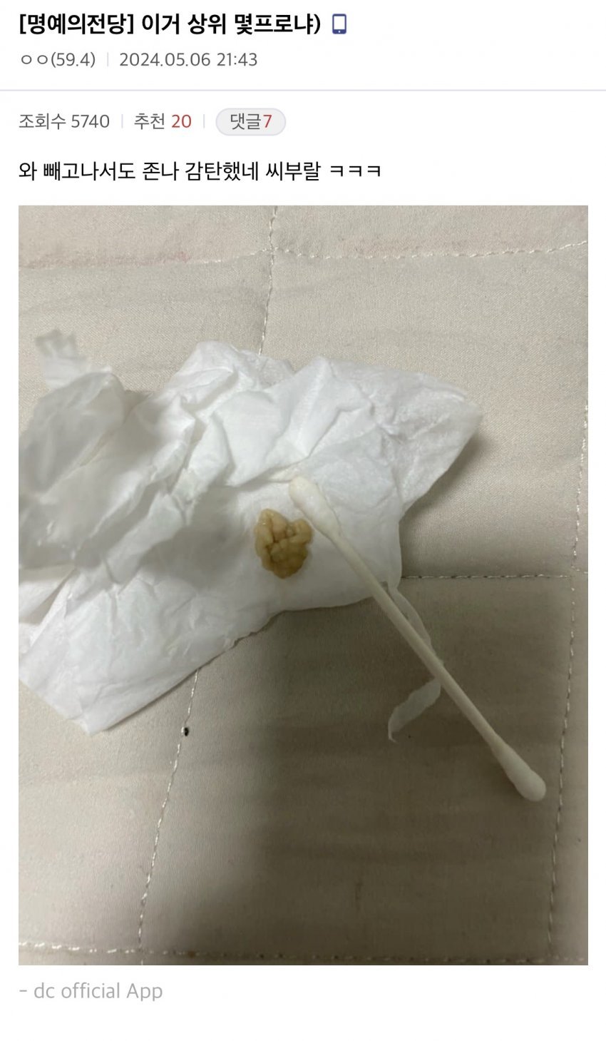 혐)편도결석(목똥) 레전드