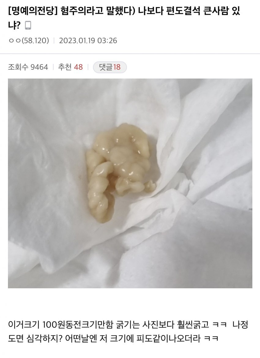 혐)편도결석(목똥) 레전드