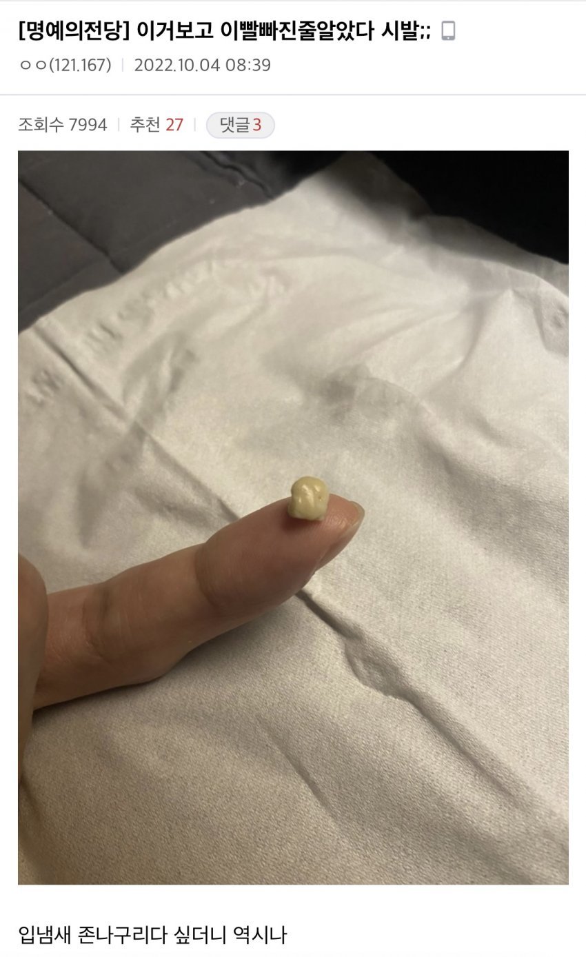 혐)편도결석(목똥) 레전드