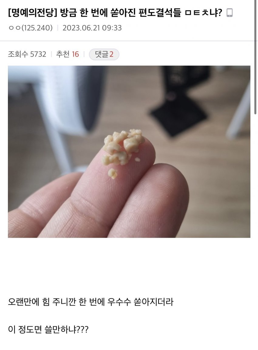 혐)편도결석(목똥) 레전드