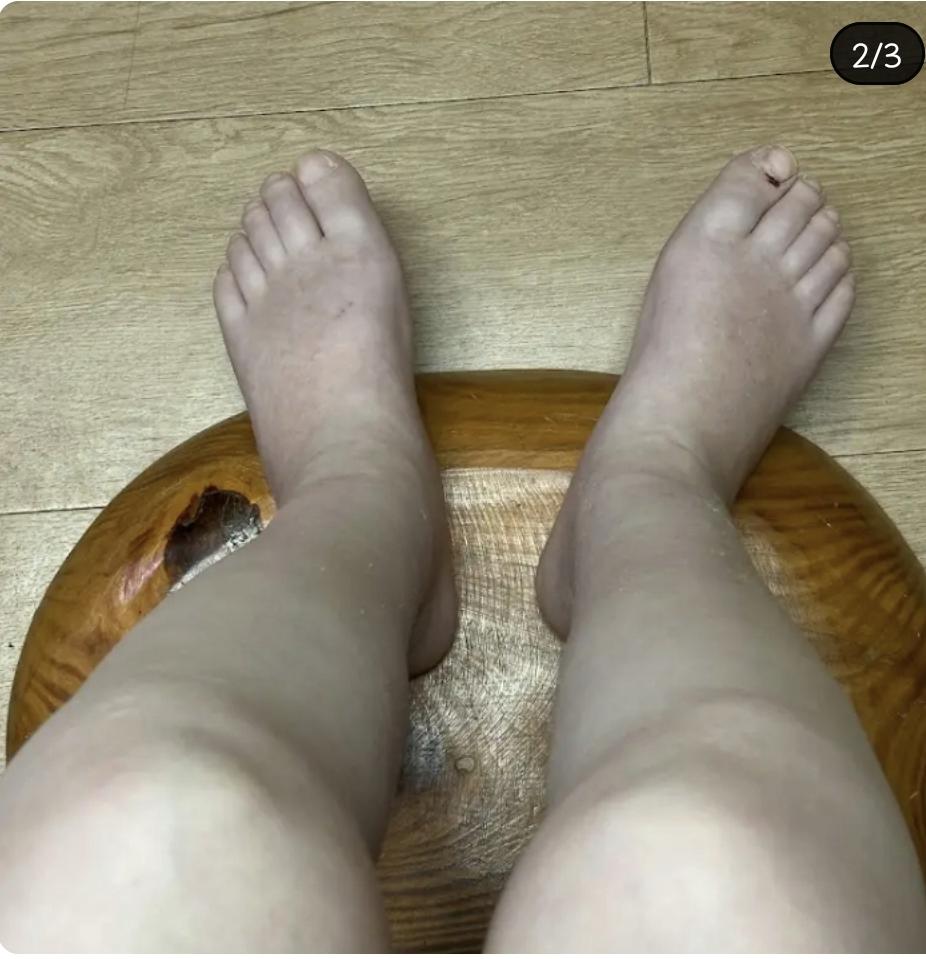 20대 암환자 유튜버 유병장수걸 오늘자 근황 업로드