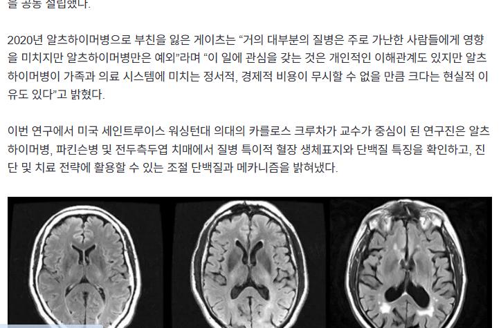 빌 게이츠 “치매, 사형선고 아닌 날 임박”…세계 최대 단백질 데이터 완성