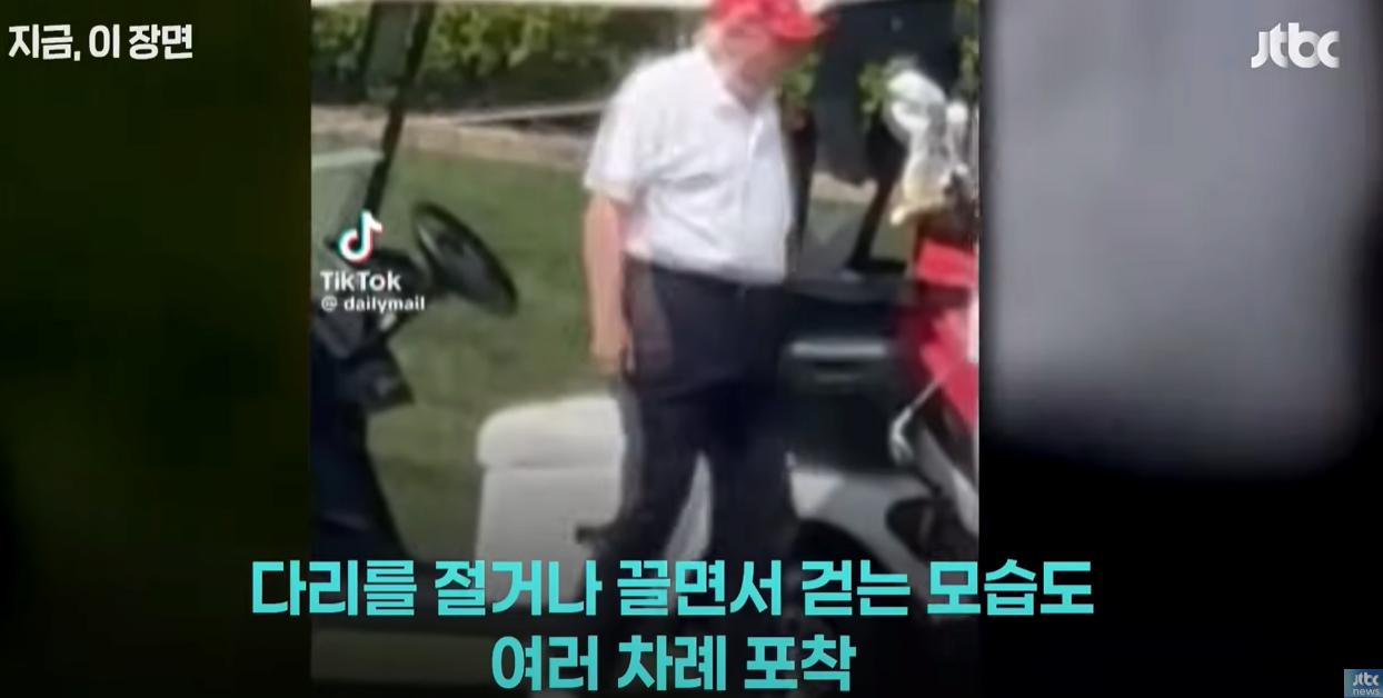 현재, 트럼프 대통령 손 상태