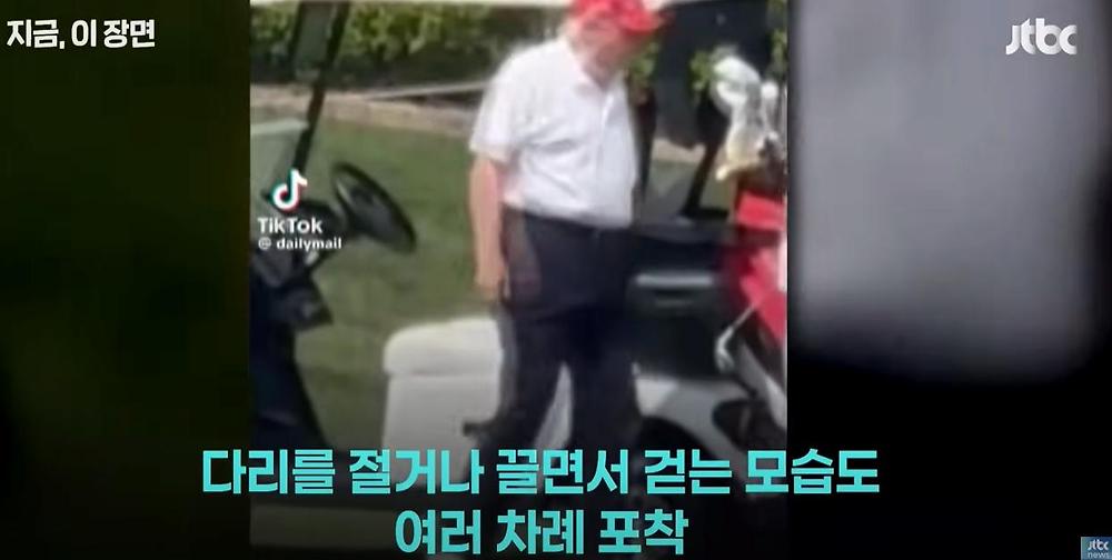트럼프 대통령 몸 상태