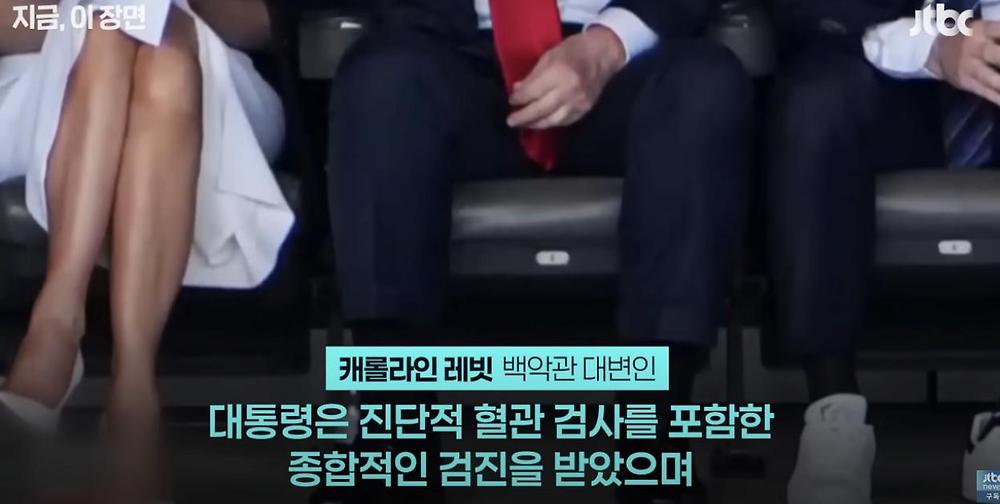 트럼프 대통령 몸 상태