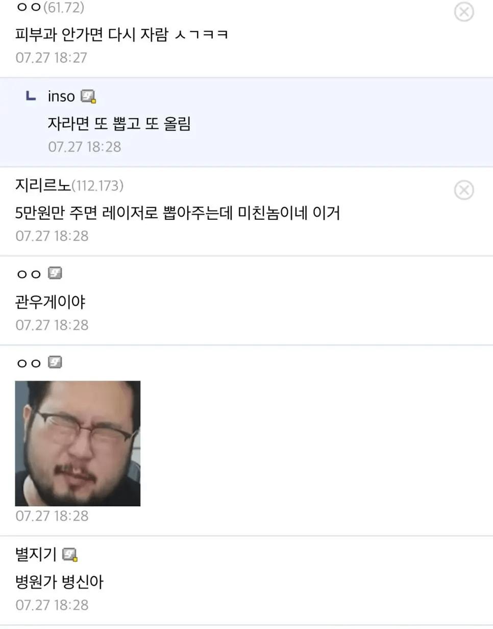 혐) 손에 자란 사마귀 뽑음