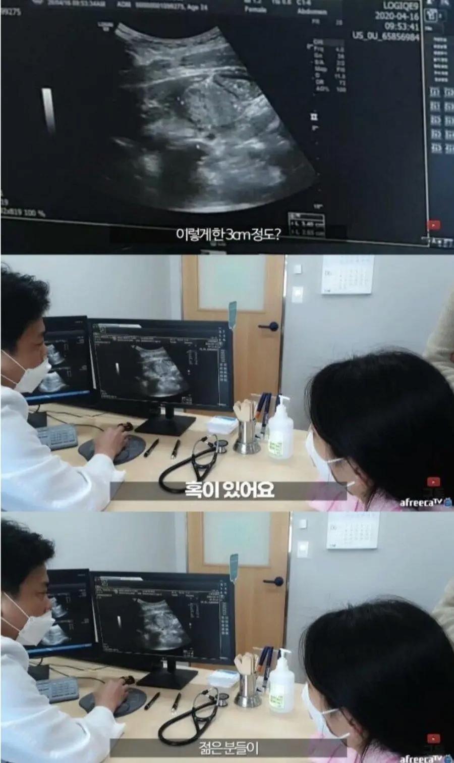 정말 운좋게 췌장암 발견해서 치료 받은 유튜버