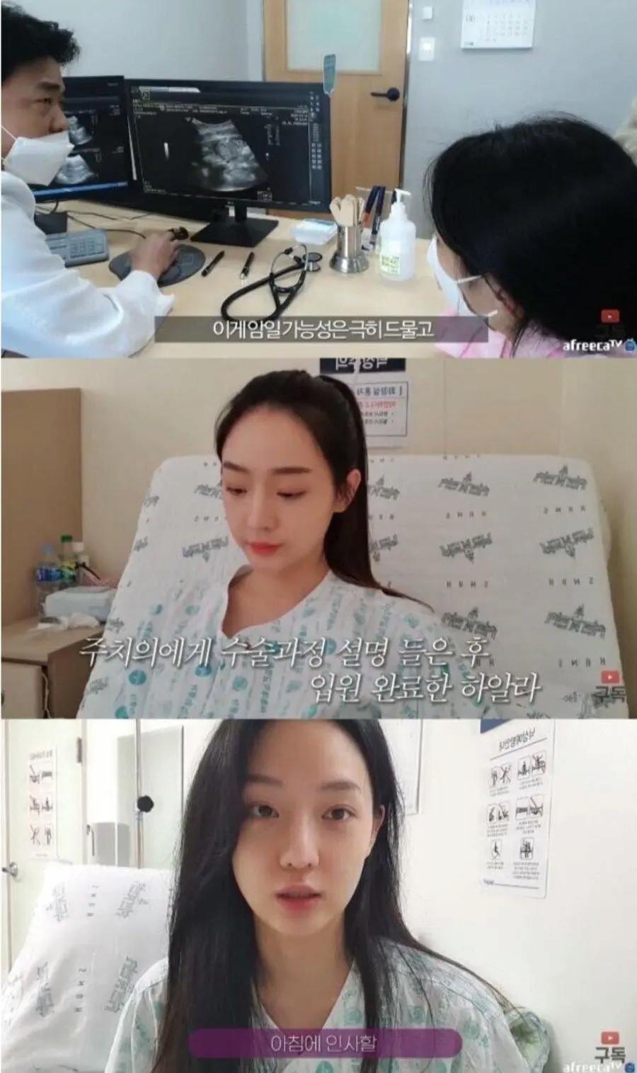 정말 운좋게 췌장암 발견해서 치료 받은 유튜버