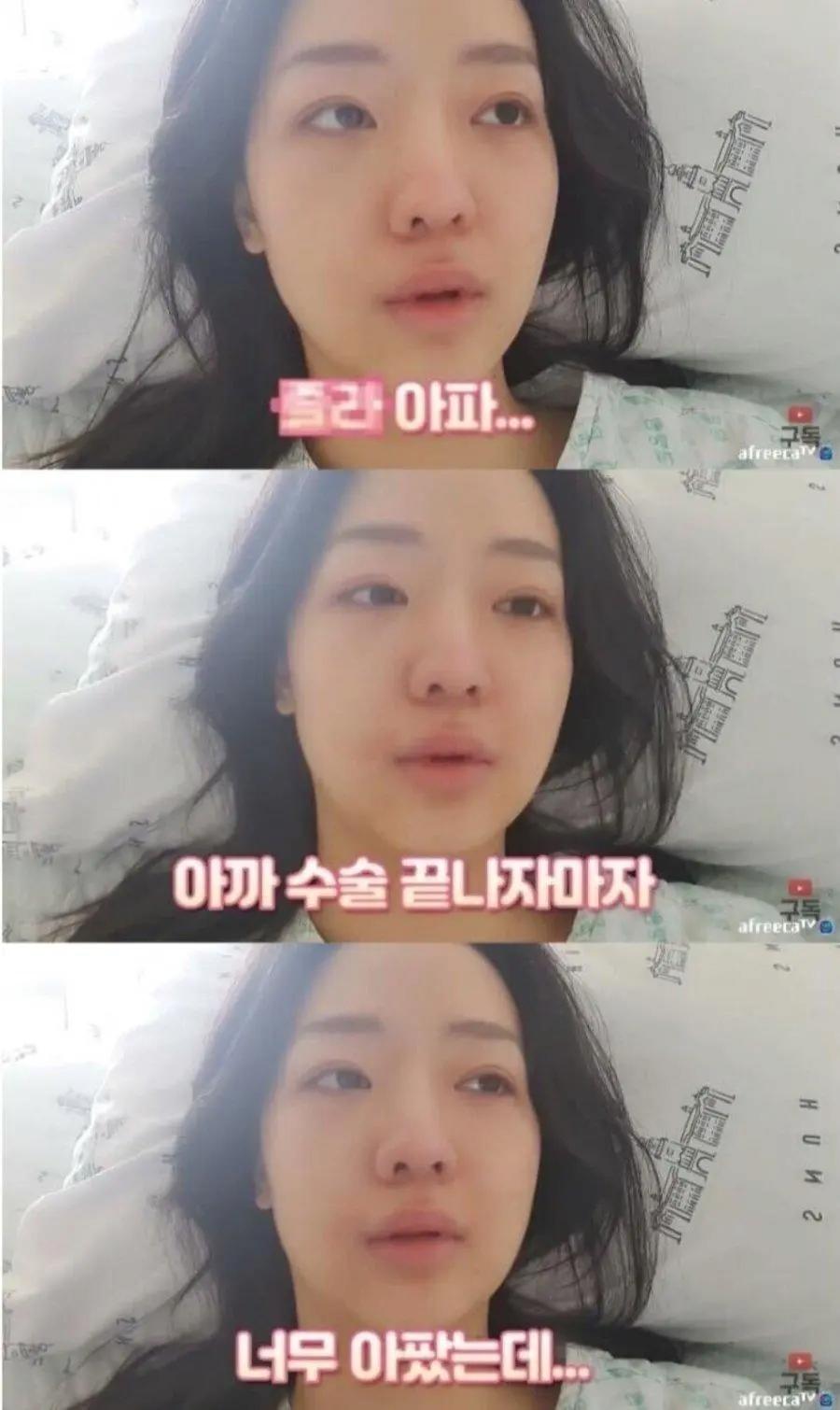 정말 운좋게 췌장암 발견해서 치료 받은 유튜버