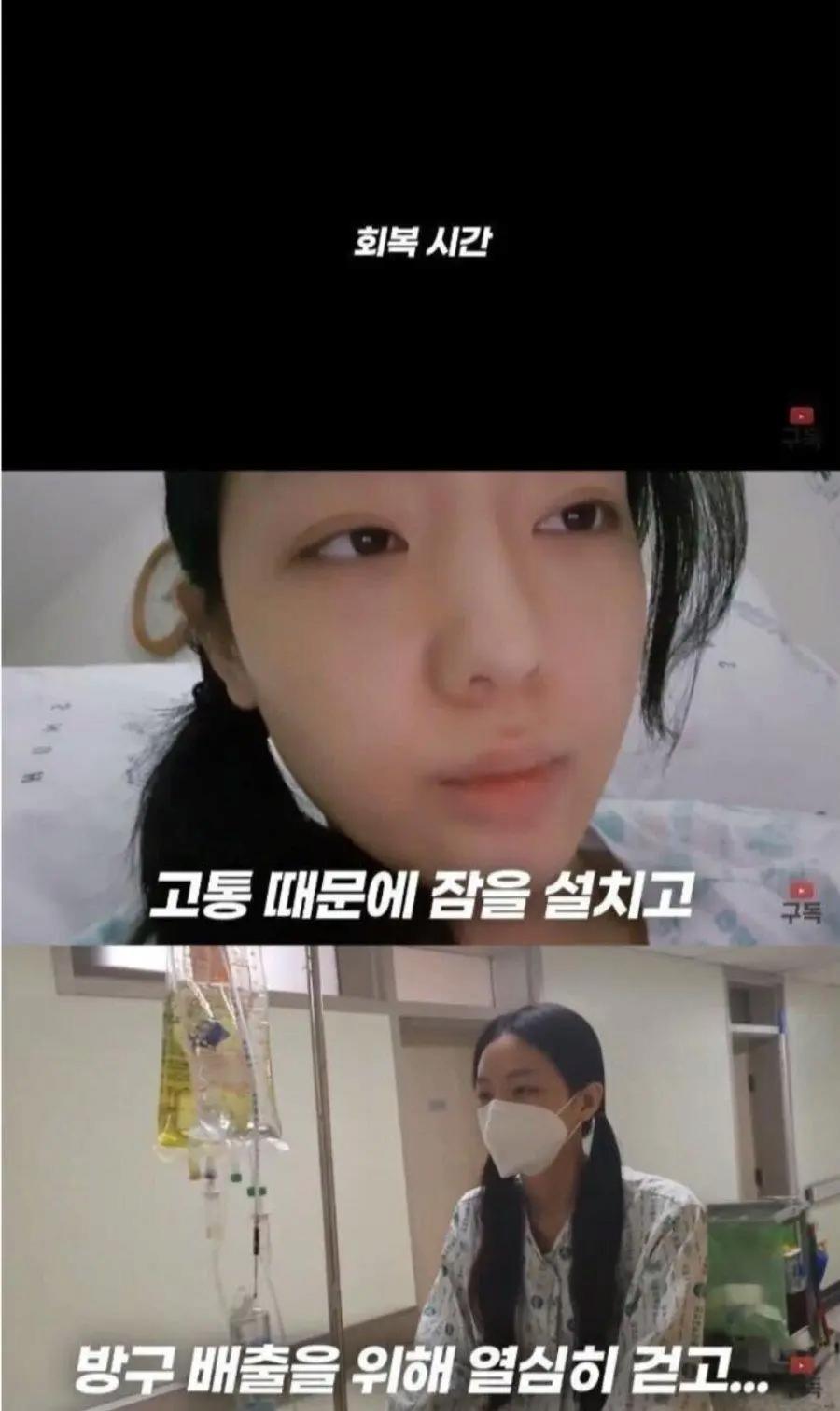 정말 운좋게 췌장암 발견해서 치료 받은 유튜버