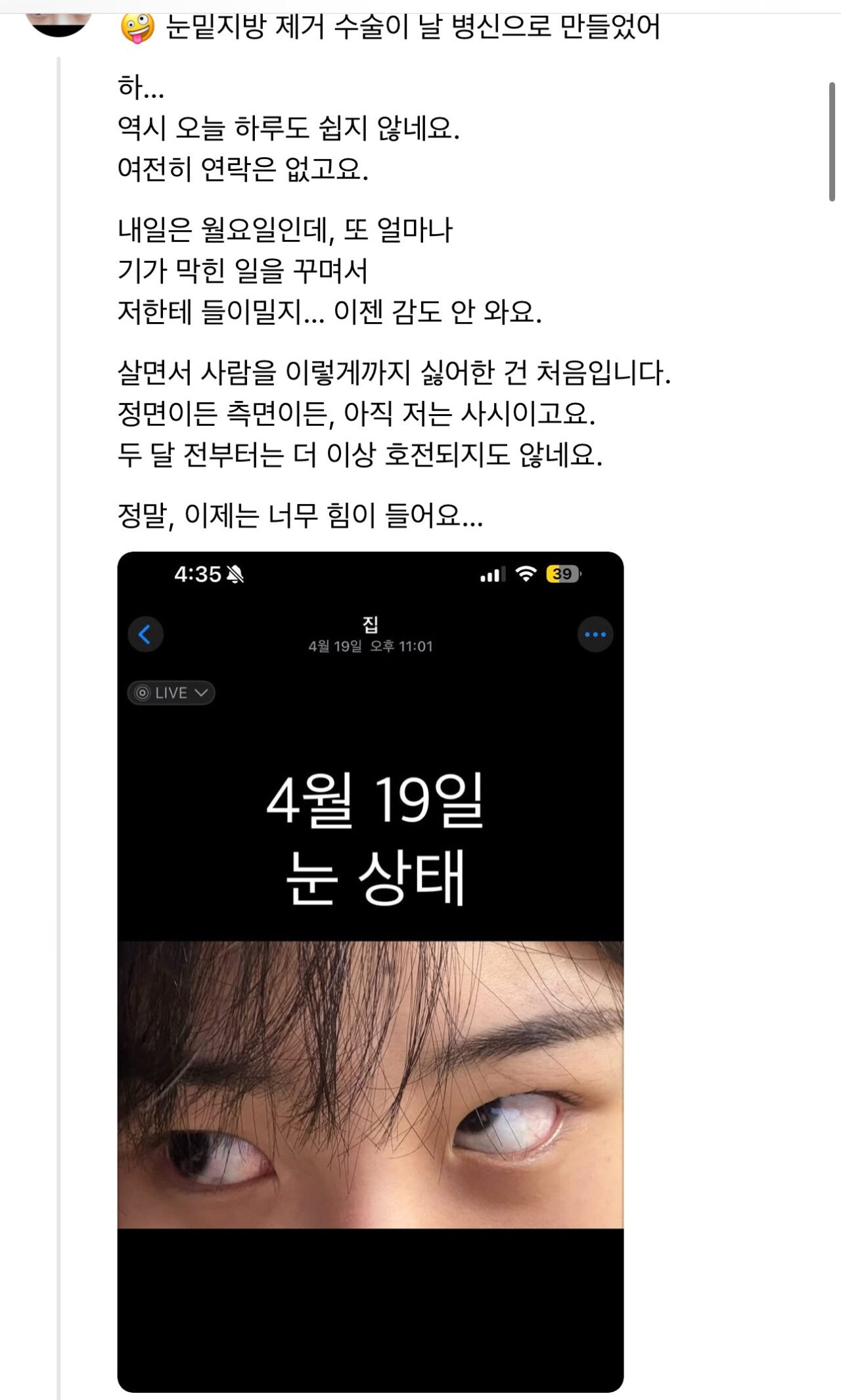 놀람주의) 눈밑지방 제거수술하고 사시 된 환자....병원 입장문