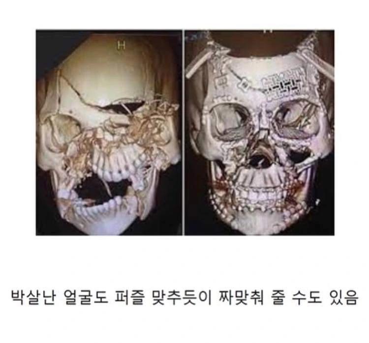 현대의학이 하지 못하는 것 한가지