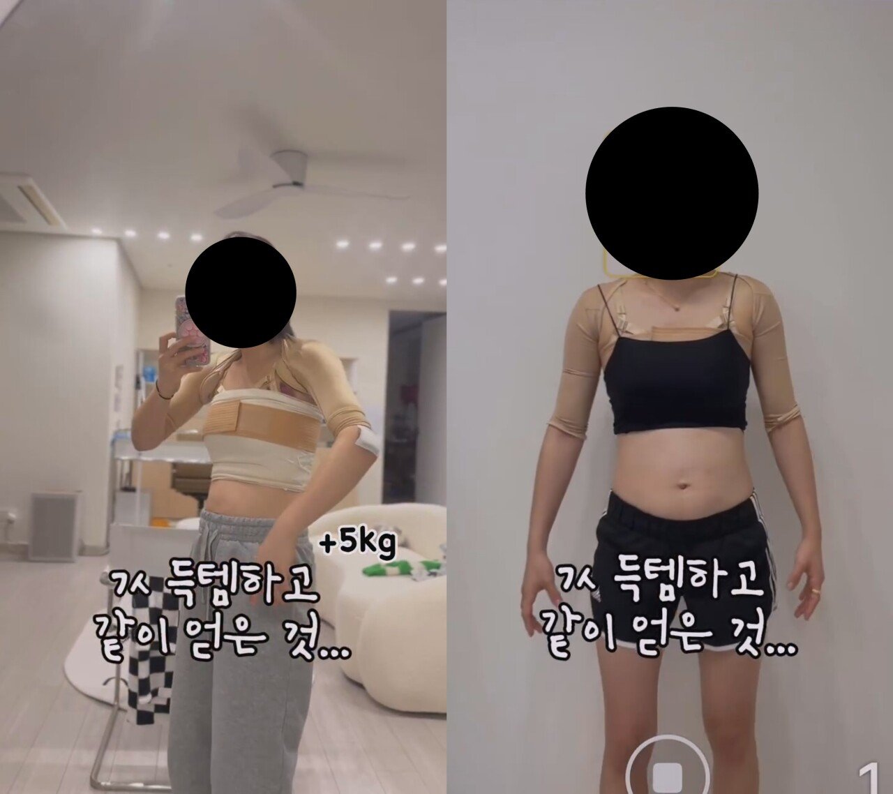 ㅇㅎ) 예전보다 많이 대중화 된 거 같은 성형수술 분야