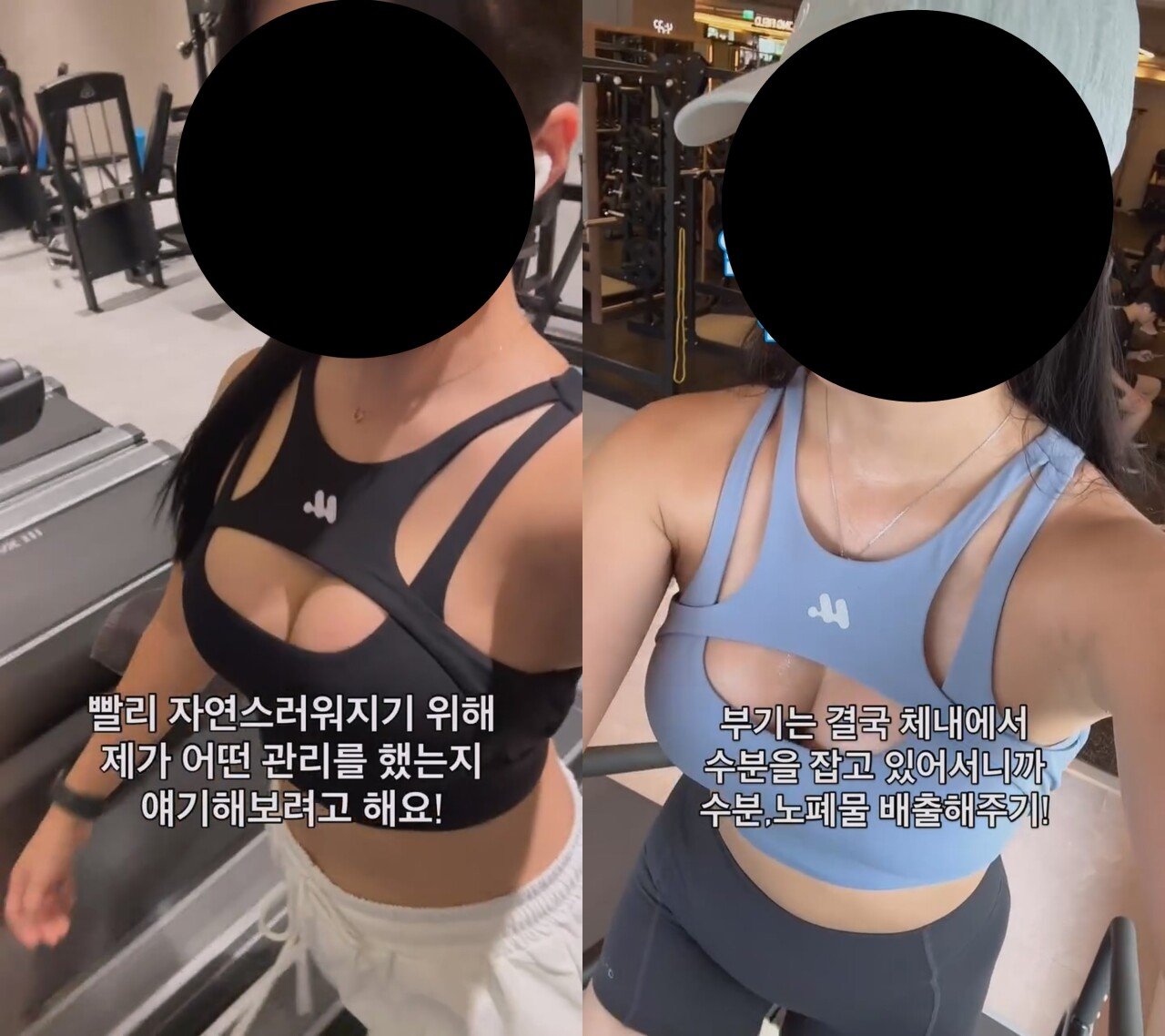 ㅇㅎ) 예전보다 많이 대중화 된 거 같은 성형수술 분야