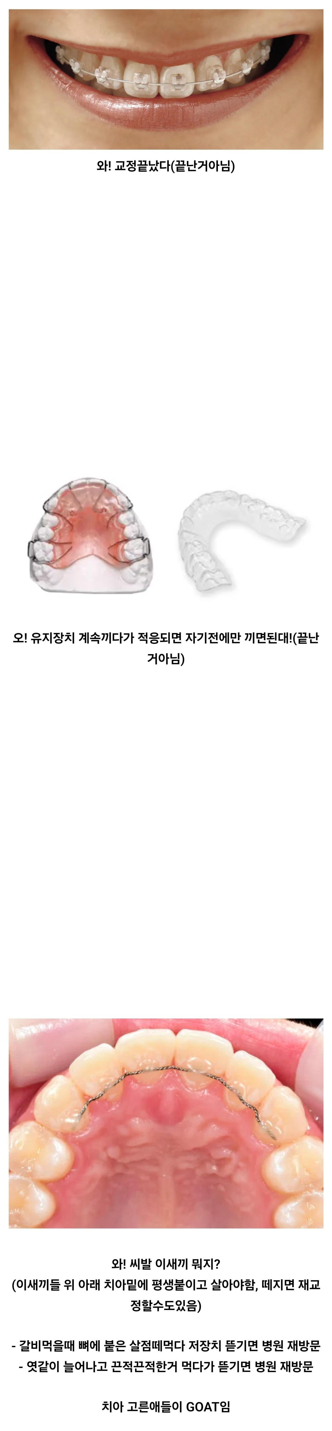 대부분 모르는 치아 교정인들의 삶.