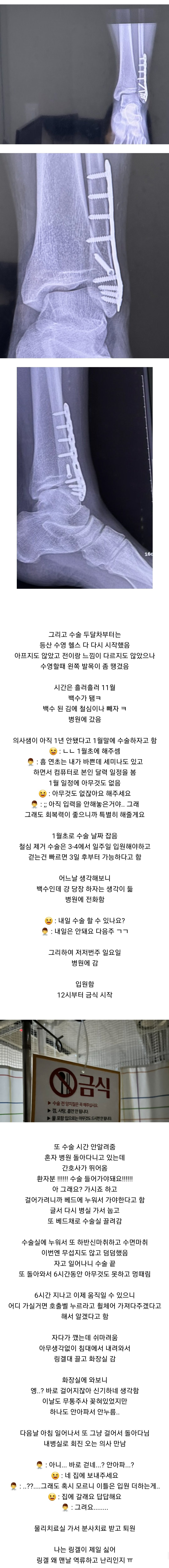 발목 부러졌는데 하나도 안아프다는 여자의 11개월 뒤 ㄷㄷ