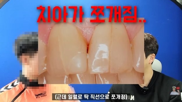 잠수함을 타면 겪는 신체적 변화