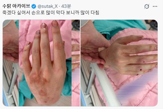 유튜버 수탉 납치, 구조상황 총 정리 ㄷㄷ
