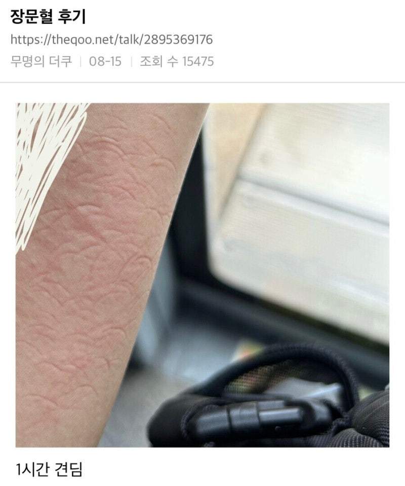 급똥 막는 혈 후기