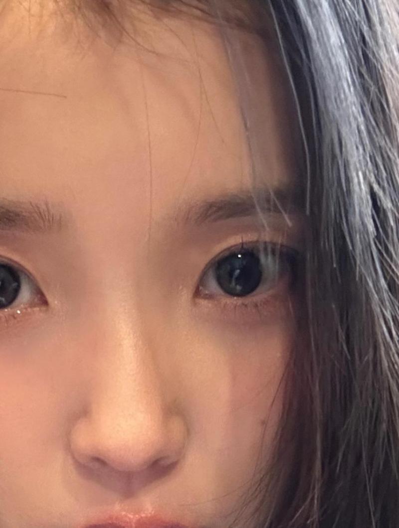 아이유