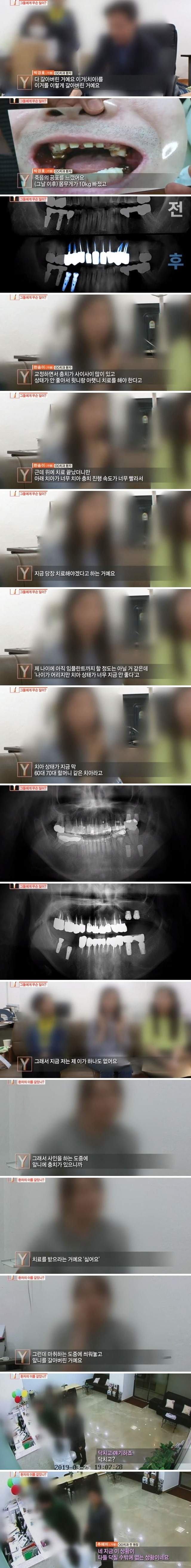 [스압] 치과의사들도 충격 받은 진료사진