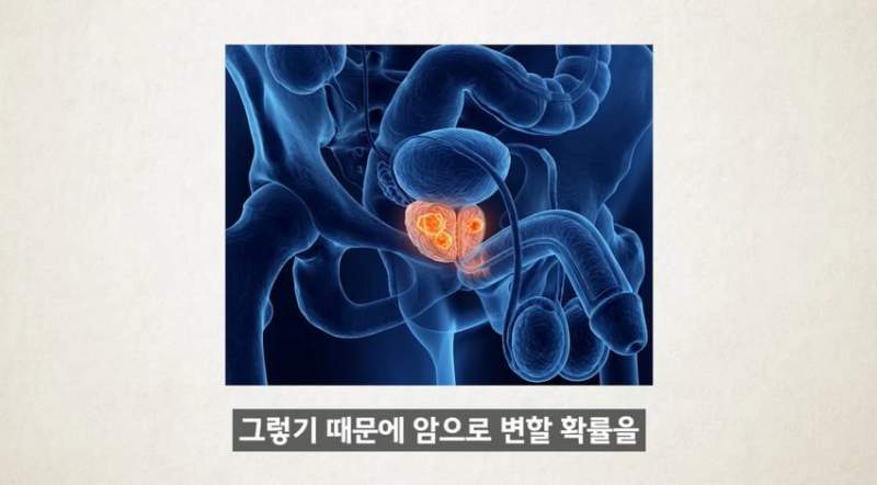 한달에 21번 사정하라.jpg