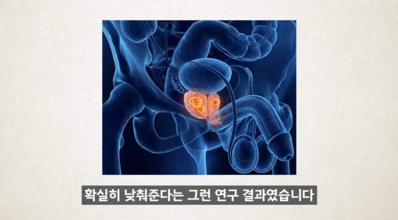 한달에 21번 사정하라.jpg