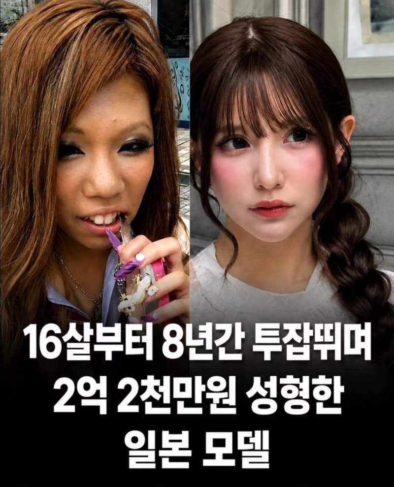 2억 이상 들여 성형한 일본 모델