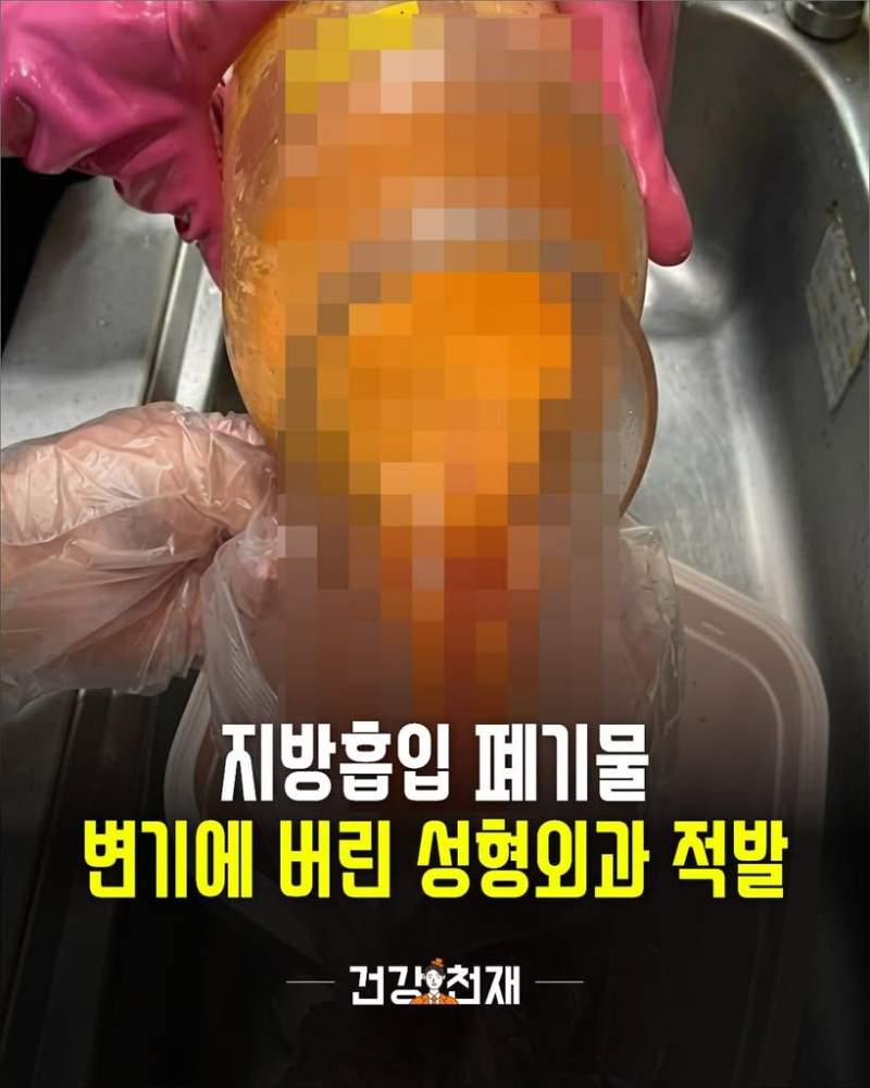 지금껏 우린 뚱땡이들의 비계를 먹고 있었다